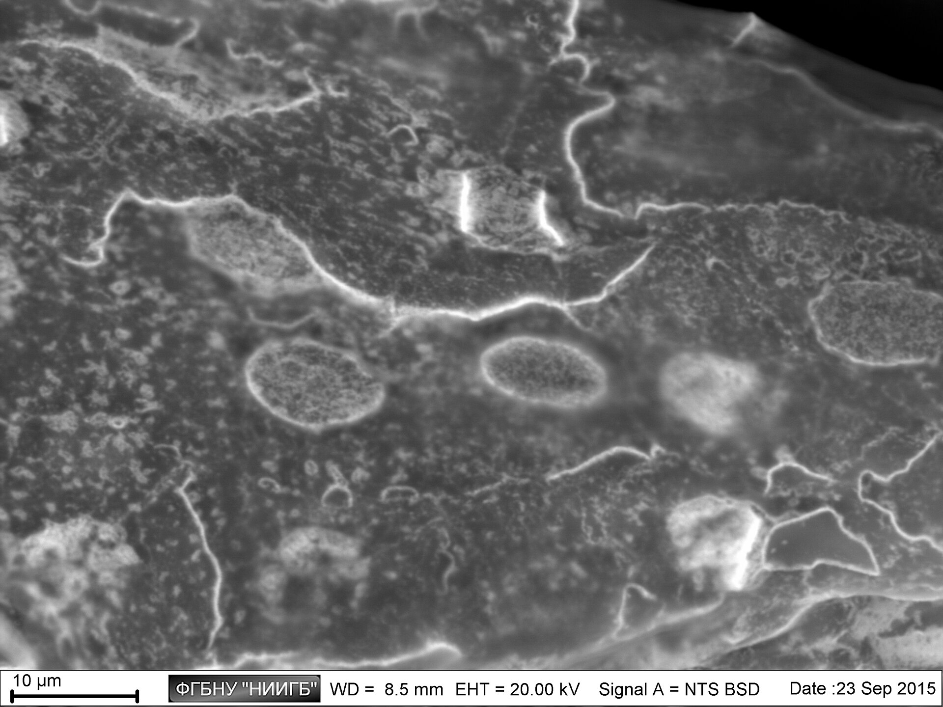 Scanning electron micrograph of human corneal epithelium, showing the textured cell surface a contact lens rests against.
