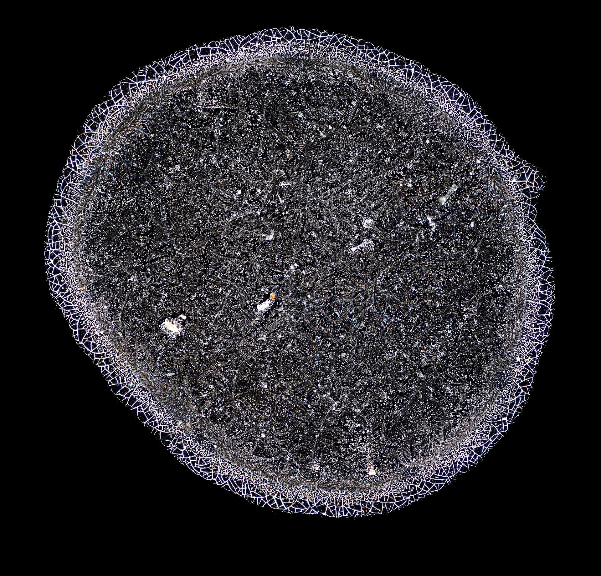 Microscope image of dried human tears forming crystalline branching patterns.