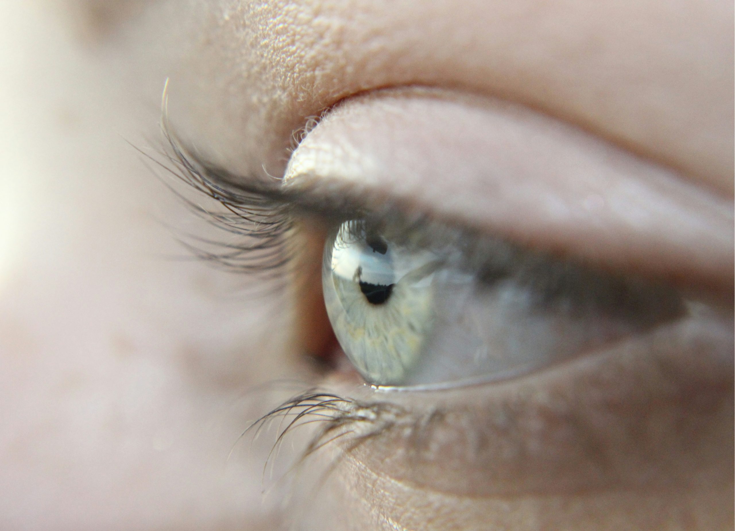 Are Contact Lenses Expensive?